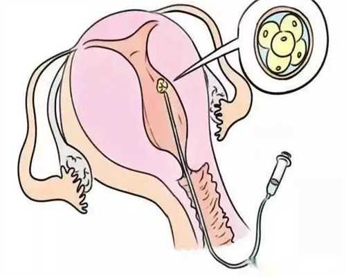 <b>同济备孕检查：张明敏,试管代孕包成功套餐&国内合法供卵</b>