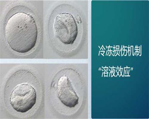 <b>卵巢癌试管基因检查怎么做</b>